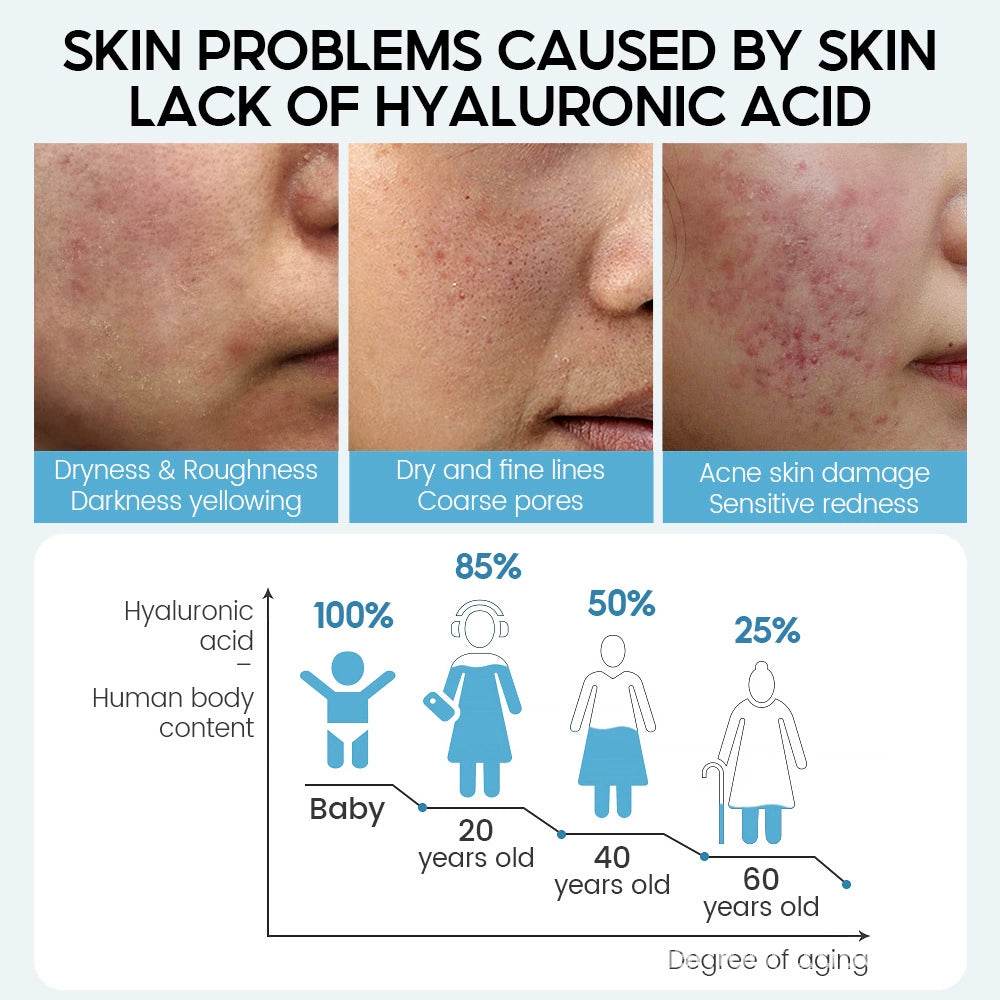 VIBRANT GLAMOUR hyaluronic acid essence Moisturize balance the skin - Price Value Store