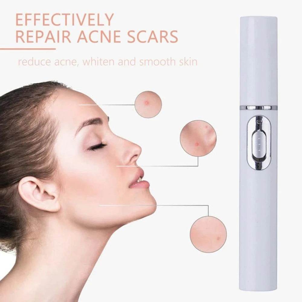 FDA-Cleared Blue Light Acne Killer | No-Skin-Contact Design - Price Value Store