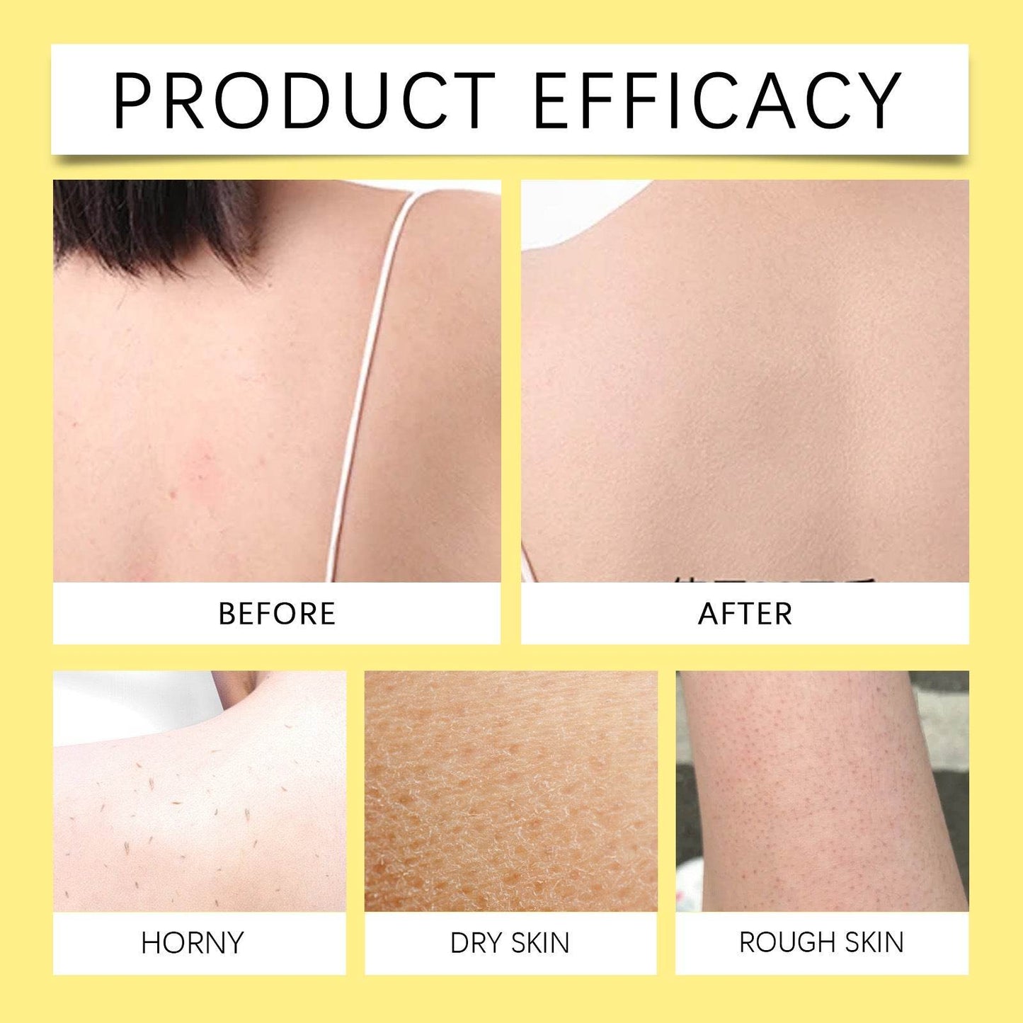 Lemon turmeric kojic acid soap - Price Value Store