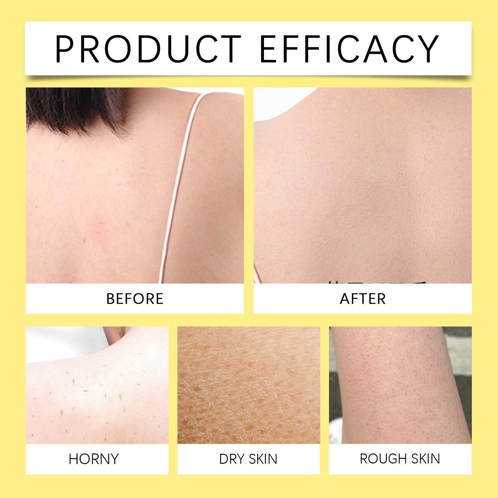 Lemon turmeric kojic acid soap - Price Value Store