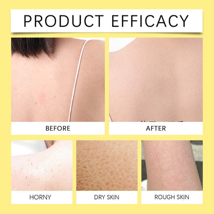 Lemon turmeric kojic acid soap - Price Value Store