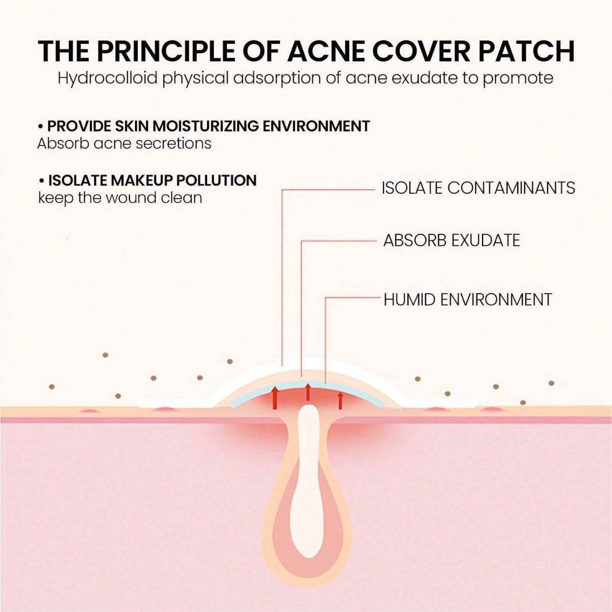 Acne Stickers - Price Value Store