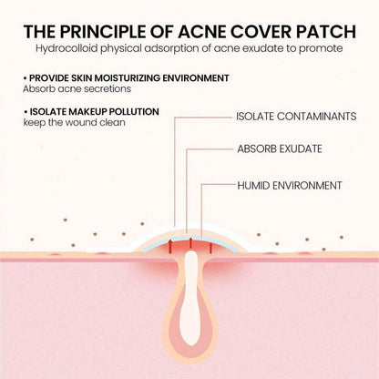 Acne Stickers - Price Value Store