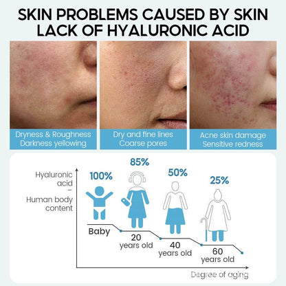 VIBRANT GLAMOUR hyaluronic acid essence Moisturize balance the skin - Price Value Store