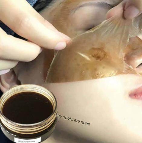 Beauty salon spot mask removing dark yellow melanin removing blackhead acne whitening freckle cleansing skin mask tearing mask - Price Value Store