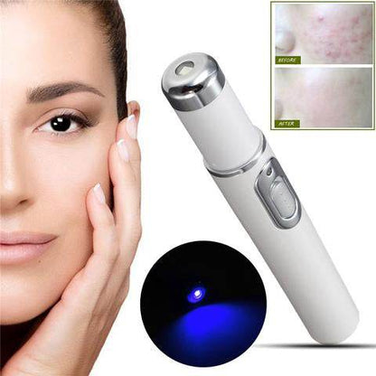 FDA-Cleared Blue Light Acne Killer | No-Skin-Contact Design - Price Value Store