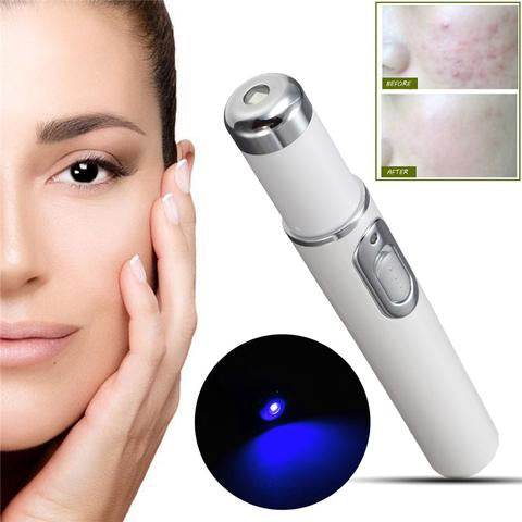 FDA-Cleared Blue Light Acne Killer | No-Skin-Contact Design - Price Value Store