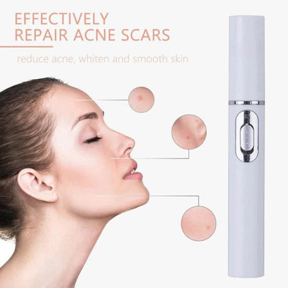 FDA-Cleared Blue Light Acne Killer | No-Skin-Contact Design - Price Value Store