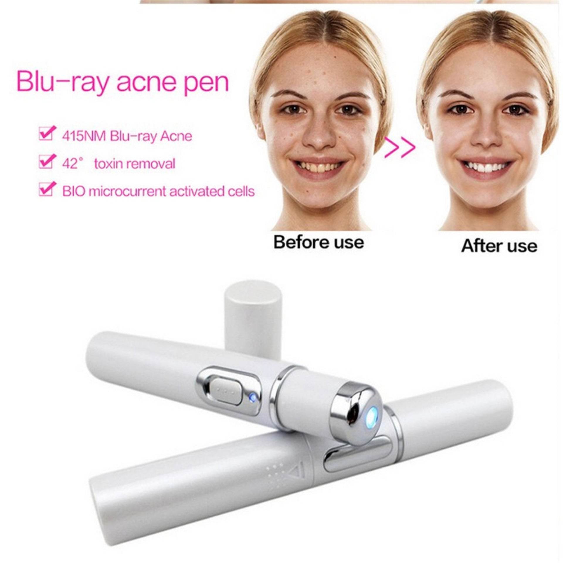 FDA-Cleared Blue Light Acne Killer | No-Skin-Contact Design - Price Value Store