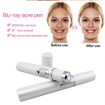 FDA-Cleared Blue Light Acne Killer | No-Skin-Contact Design - Price Value Store